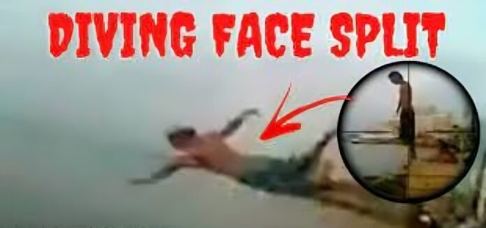 Split Face Diving Accident